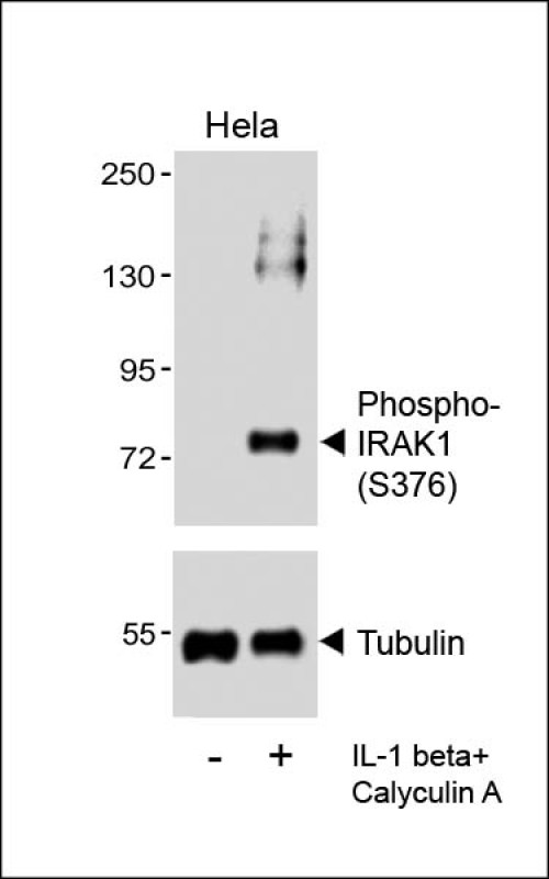 Rabbit Polyclonal Antibody to Phospho-IRAK1(S376)