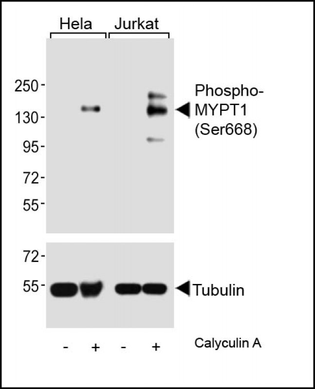 Rabbit Polyclonal Antibody to Phospho-MYPT1 (Ser668)