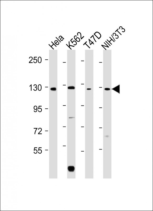Rabbit Polyclonal Antibody to ROR2
