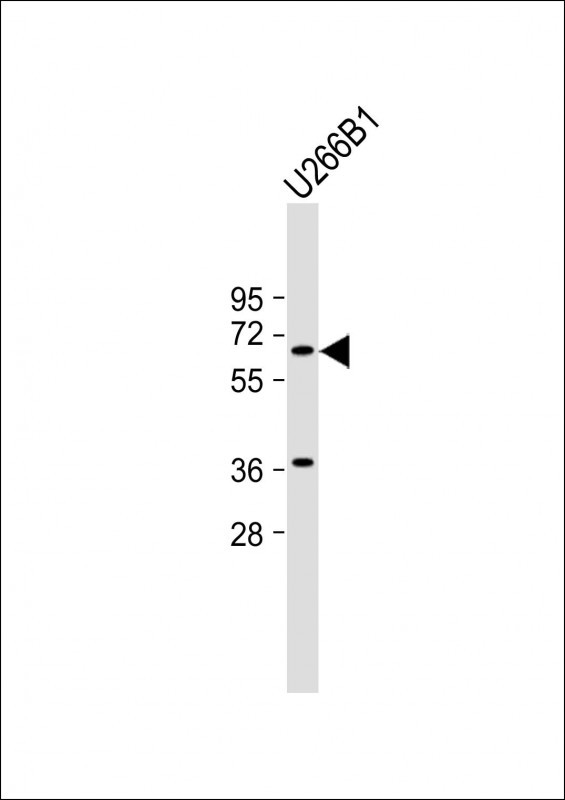 Rabbit Polyclonal Antibody to TXK (N-term)