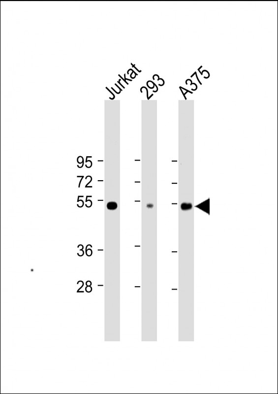 Mouse Monoclonal Antibody to RBCK1 (UBCE7IP3)