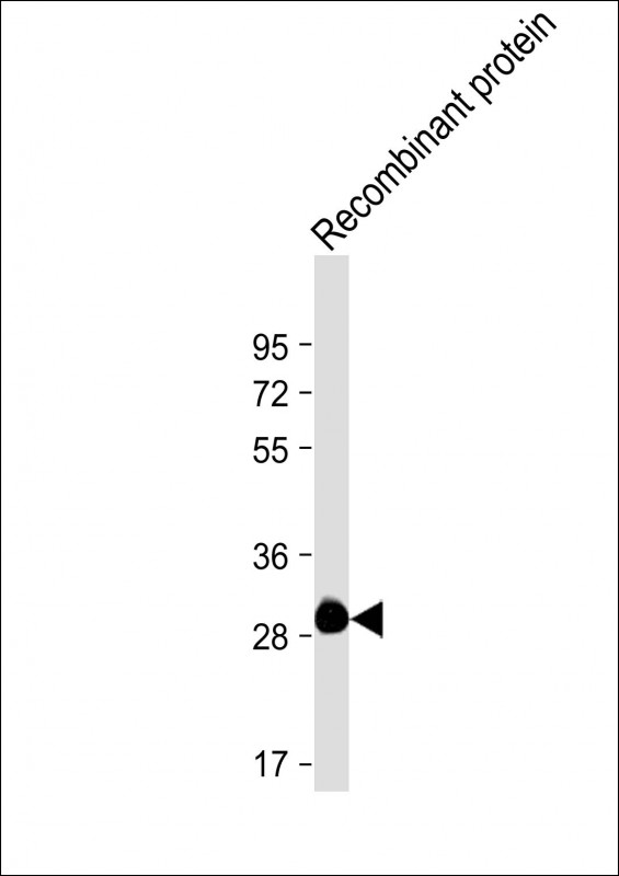 Mouse Monoclonal Antibody to ROS1
