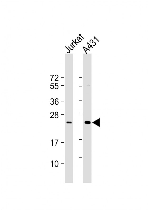 Mouse Monoclonal Antibody to RAB7L1