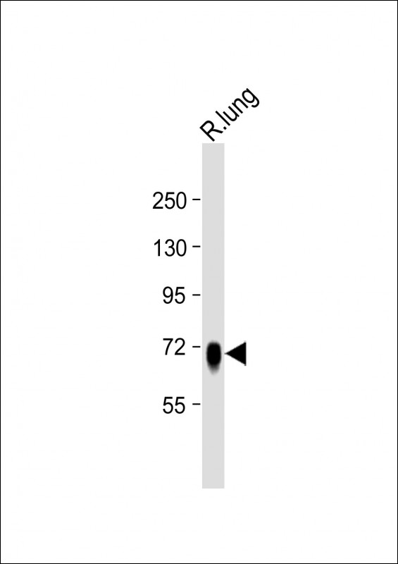 Rabbit Polyclonal Antibody to ST7