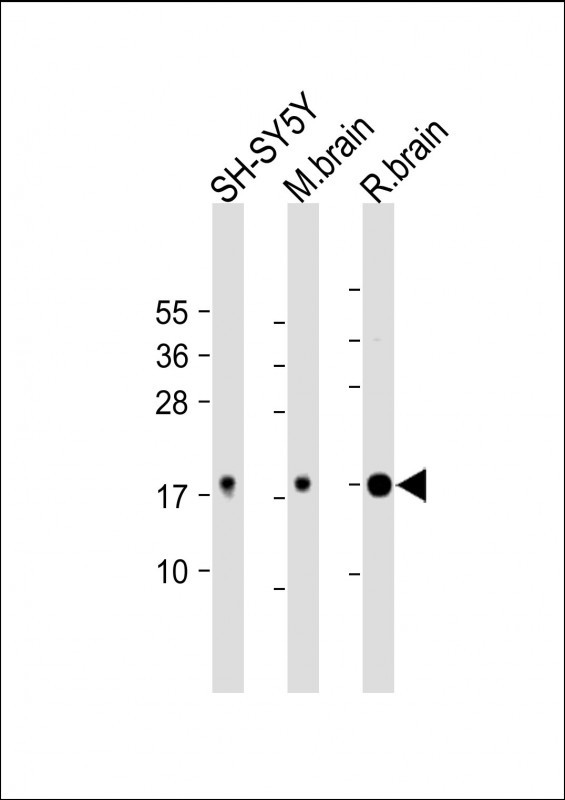 Rabbit Polyclonal Antibody to Calmodulin