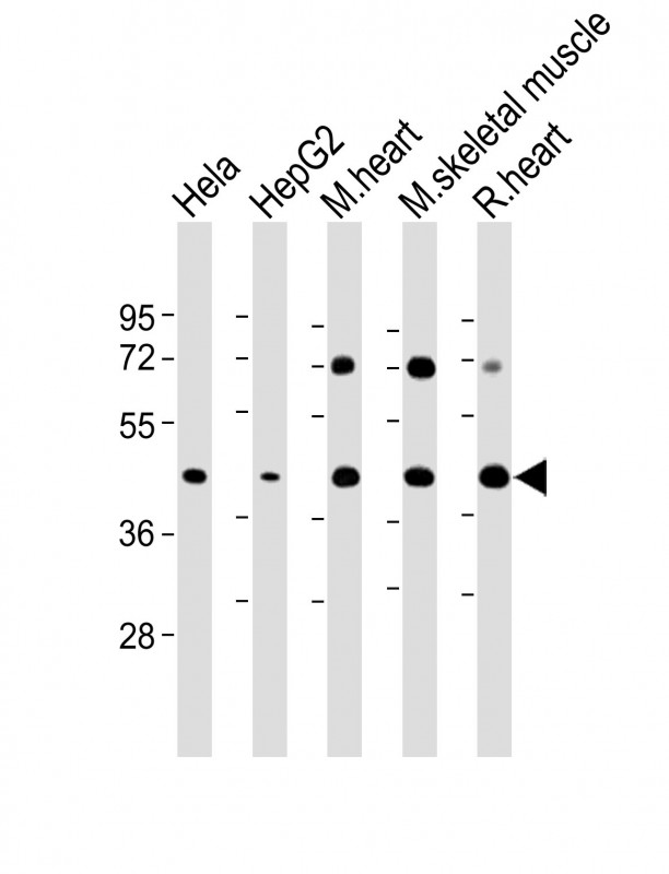 Rabbit Polyclonal Antibody to GYG1
