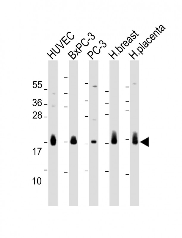 Rabbit Polyclonal Antibody to CD59