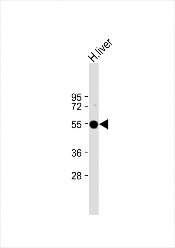 Rabbit Polyclonal Antibody to FADS2