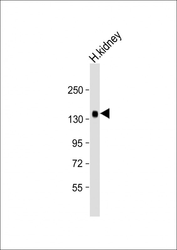 Rabbit Polyclonal Antibody to KL