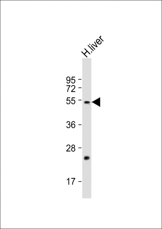 Rabbit Polyclonal Antibody to FADS2