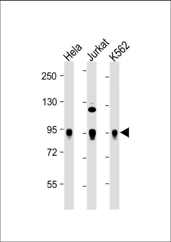 Rabbit Polyclonal Antibody to Wee1(S123)