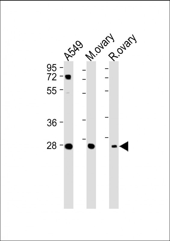 Rabbit Polyclonal Antibody to IGFBP4 (N-term)