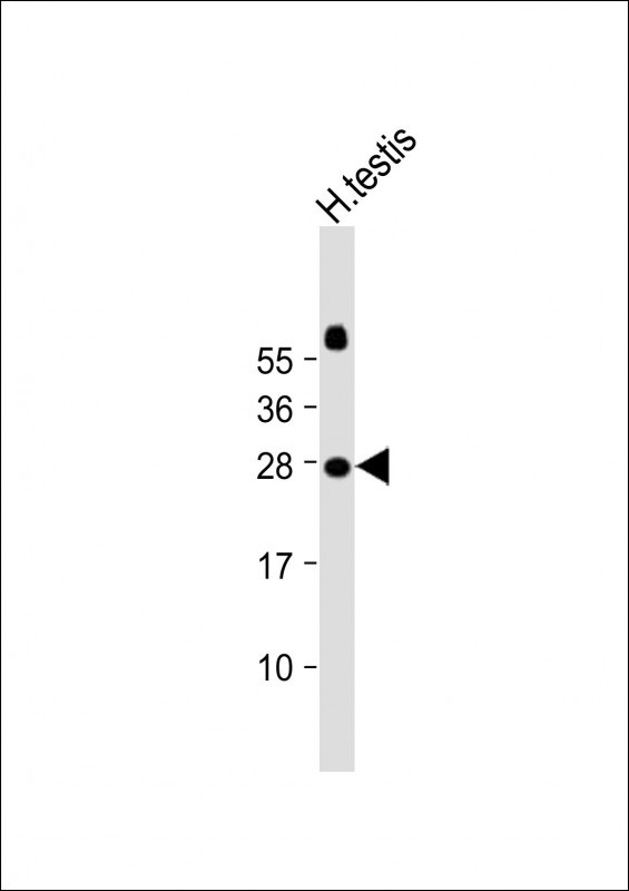 Rabbit Polyclonal Antibody to JAZF1 (N-term)