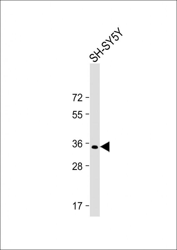 Rabbit Polyclonal Antibody to PRRT2
