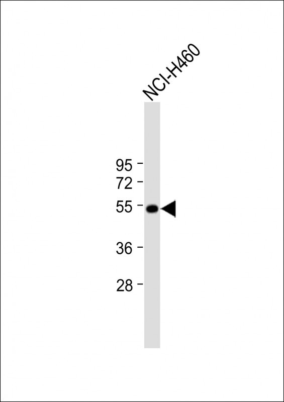 Rabbit Polyclonal Antibody to T (N-term)