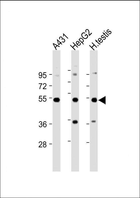 Rabbit Polyclonal Antibody to STK25
