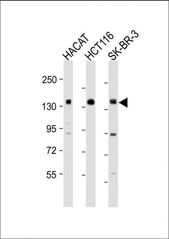 Rabbit Polyclonal Antibody to MST1R