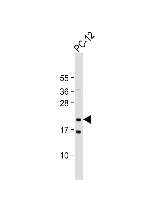 Rabbit Polyclonal Antibody to NRAS