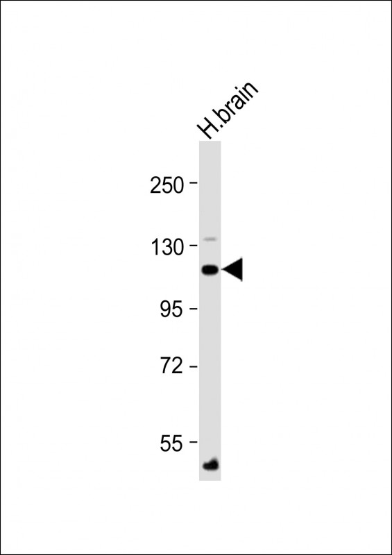 Rabbit Polyclonal Antibody to ATP1A4 (N-Term)