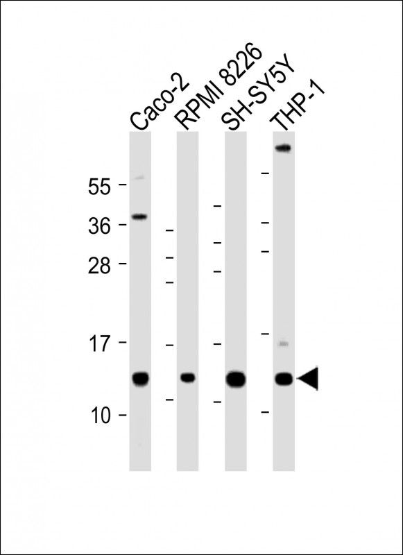 Rabbit Polyclonal Antibody to CKS2
