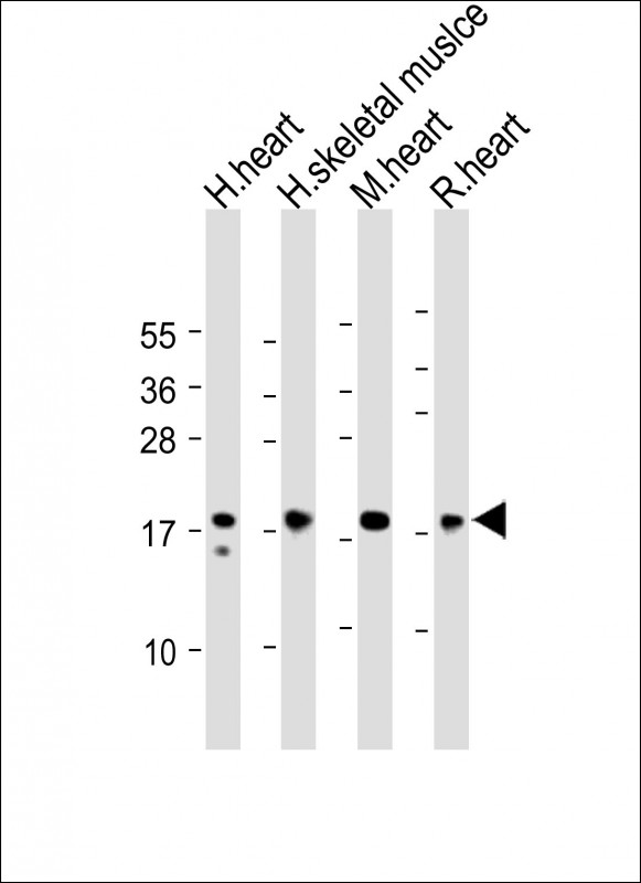 Rabbit Polyclonal Antibody to MYL2