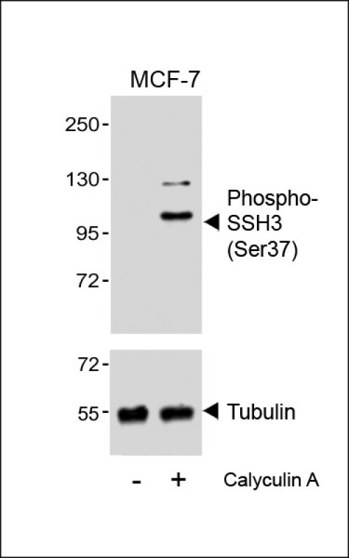 Rabbit Polyclonal Antibody to Phospho-SSH3 (Ser37)