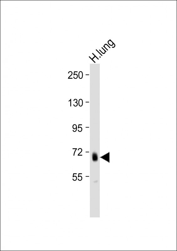 Rabbit Polyclonal Antibody to ADAMTS4