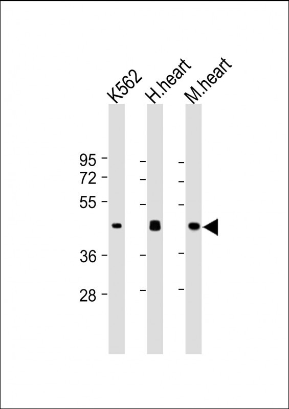 Mouse Monoclonal Antibody to PDK4