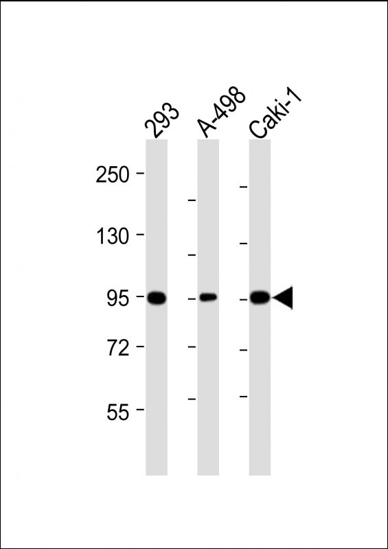 Rabbit Polyclonal Antibody to Nephrin (Y1210)