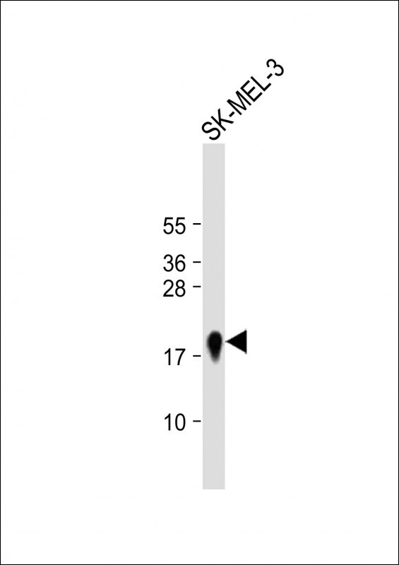 Rabbit Polyclonal Antibody to MART-1/Melan-A