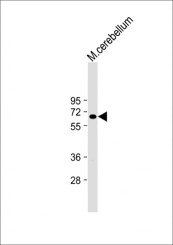 Rabbit Polyclonal Antibody to CNOT4