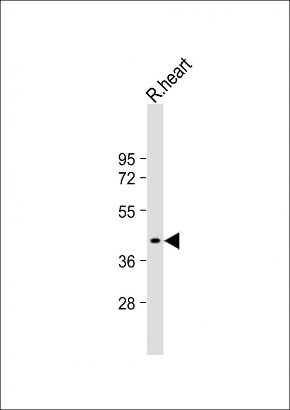 Rabbit Polyclonal Antibody to GDE1