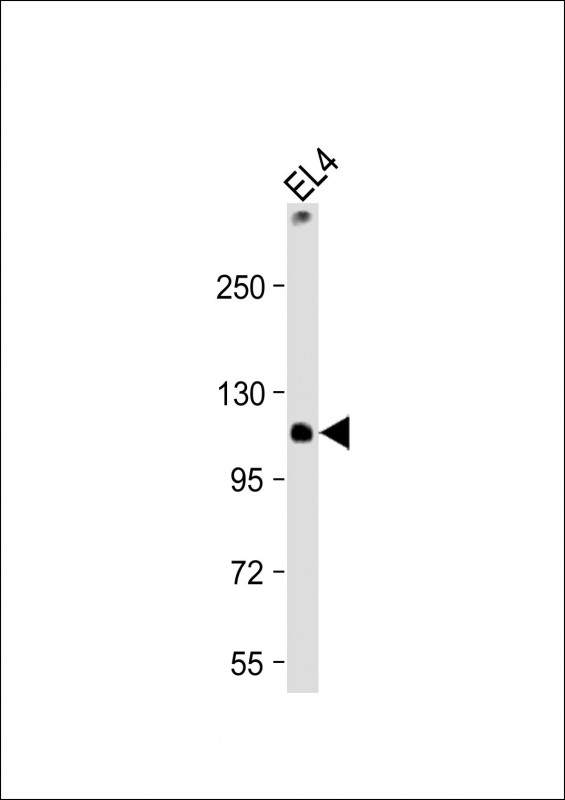 Rabbit Polyclonal Antibody to TCIRG1