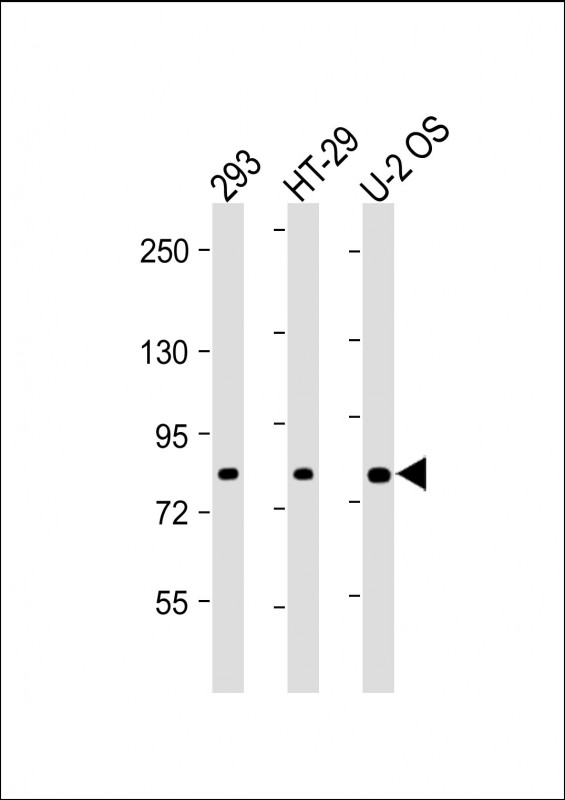 Rabbit Polyclonal Antibody to ADD1