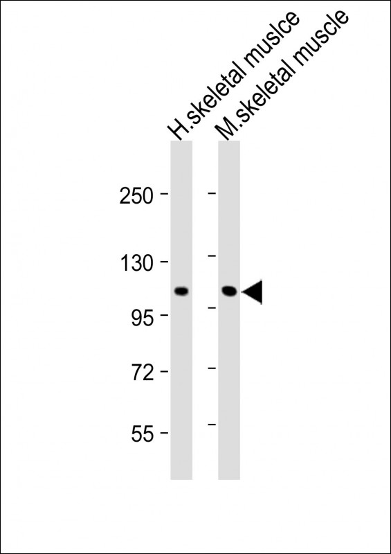 Rabbit Polyclonal Antibody to CLCN1 (N-Term)