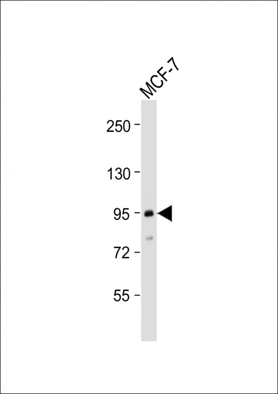 Rabbit Polyclonal Antibody to TGFBR3 (N-Term)