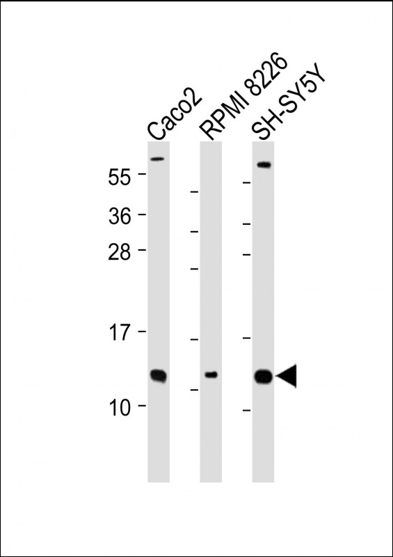 Rabbit Polyclonal Antibody to CKS2 (N-Term)