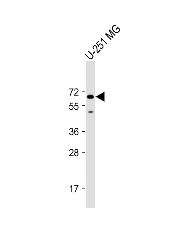 Rabbit Polyclonal Antibody to SH2B3 (N-Term)