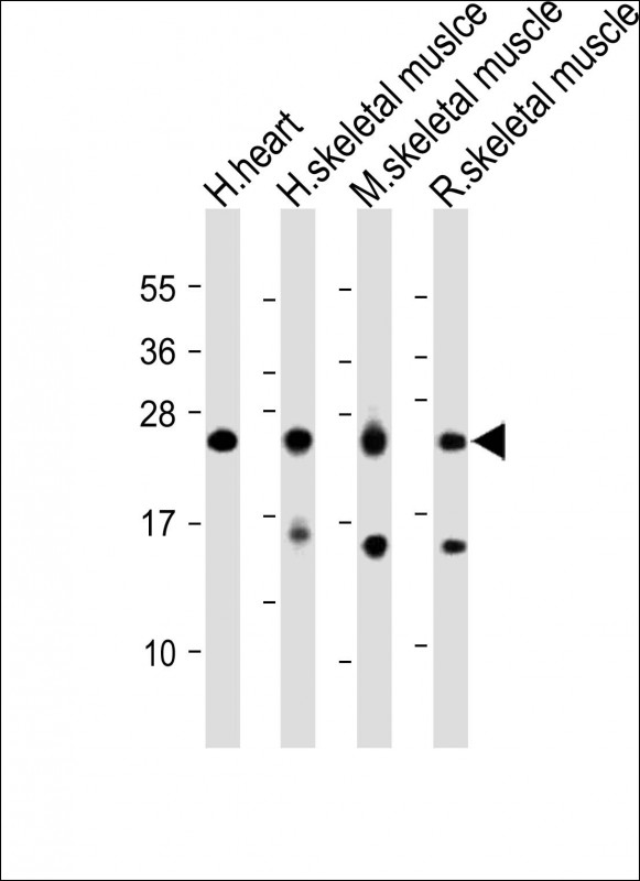 Rabbit Polyclonal Antibody to MYL1