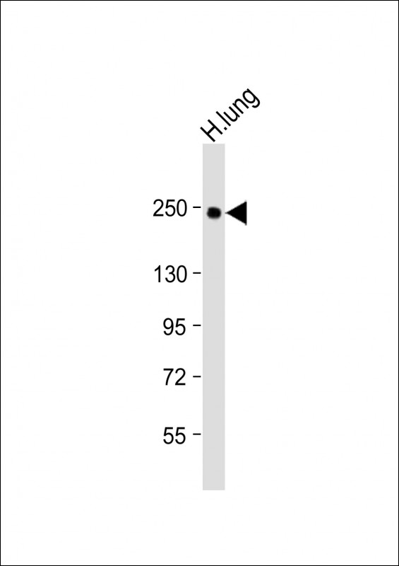 Rabbit Polyclonal Antibody to COL14A1