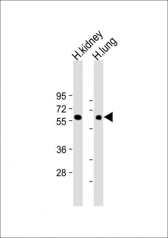 Rabbit Polyclonal Antibody to MKS1 (N-Term)