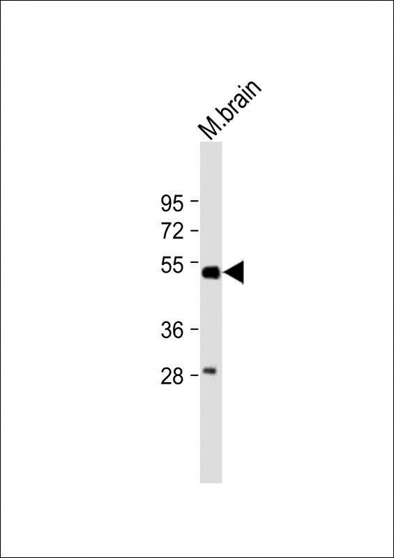 Rabbit Polyclonal Antibody to beta Tubulin