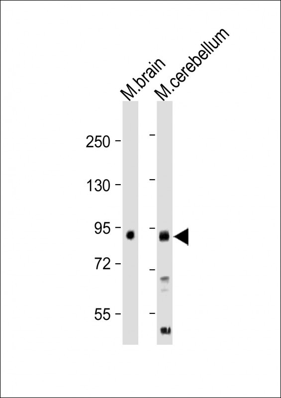 Rabbit Polyclonal Antibody to LINGO-1(LRRN6A)-S596 (C-term)