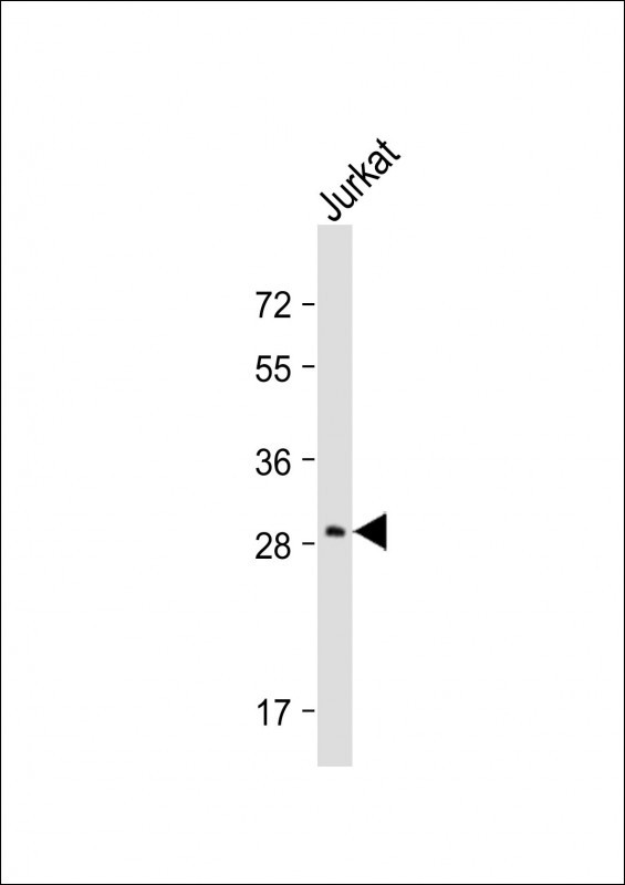 Rabbit Polyclonal Antibody to AQP5