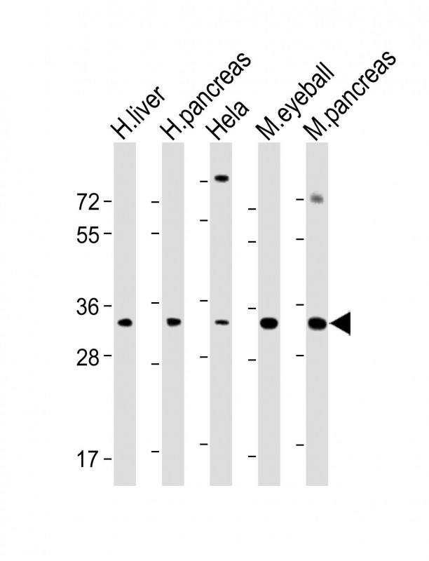 Rabbit Polyclonal Antibody to SFRP5