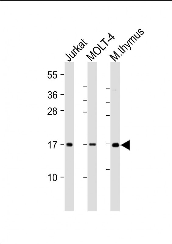 Rabbit Polyclonal Antibody to CD3Z