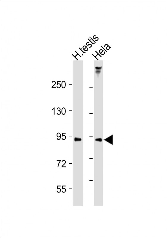Rabbit Polyclonal Antibody to LOXL4