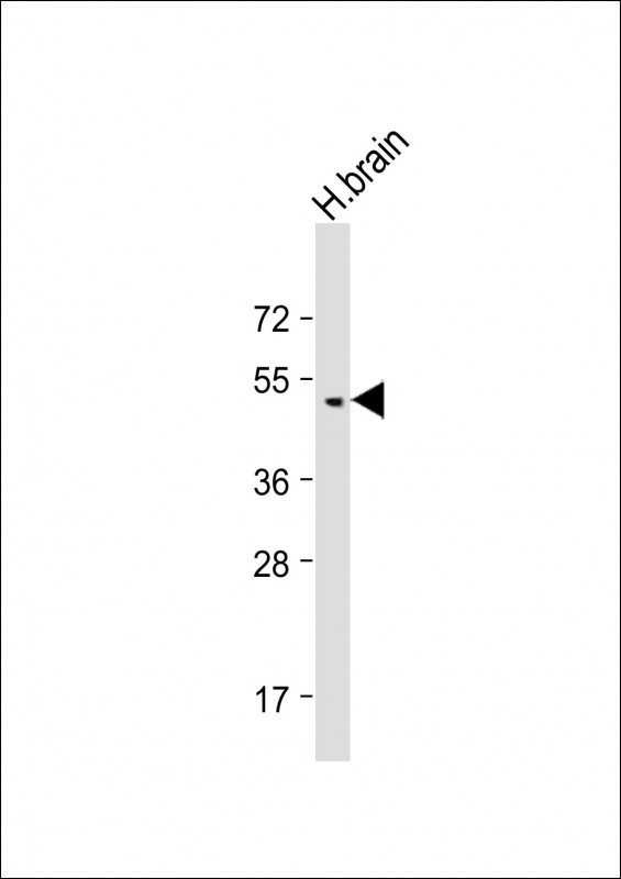 Rabbit Polyclonal Antibody to BMP8B
