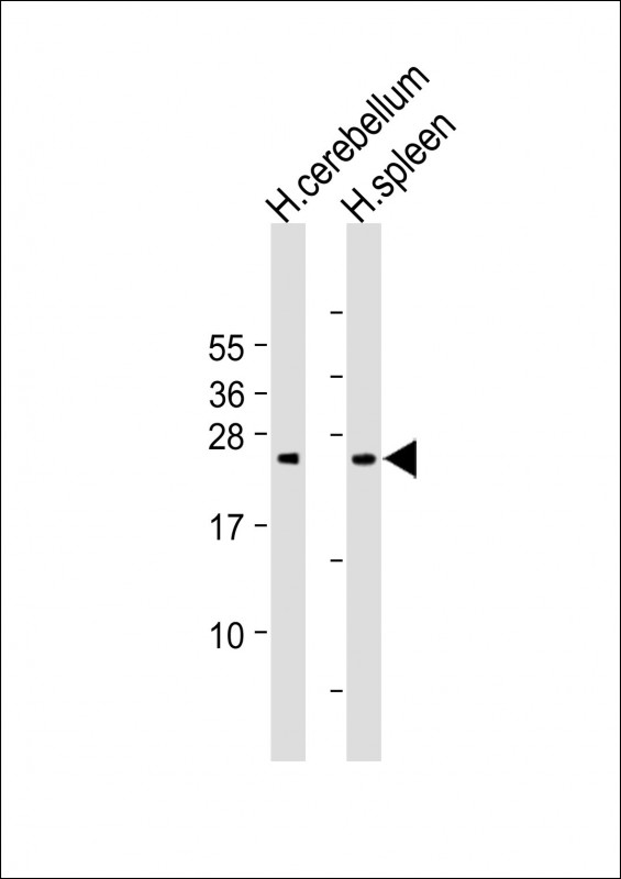 Rabbit Polyclonal Antibody to GCA (N-Term)
