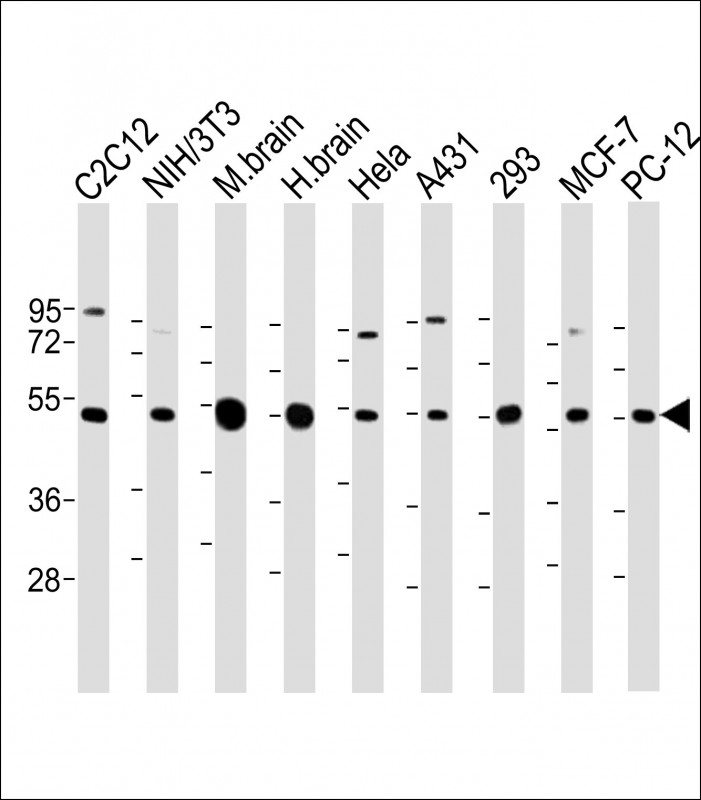 Rabbit Polyclonal Antibody to beta II Tubulin